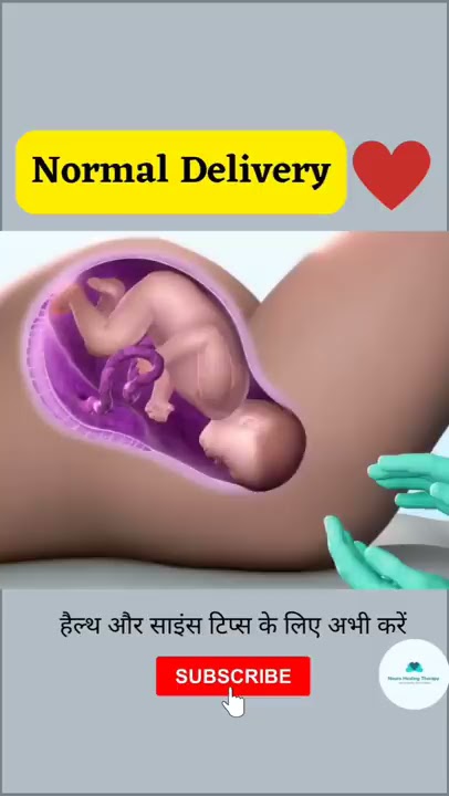 NORMAL CHILD DELIVERY | BABY BIRTH #shorts #youtubeshorts #viral