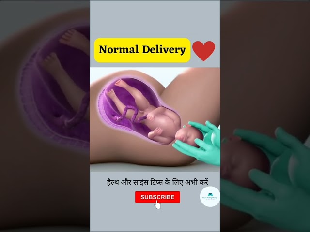 NORMAL CHILD DELIVERY | BABY BIRTH #shorts #youtubeshorts #viral class=