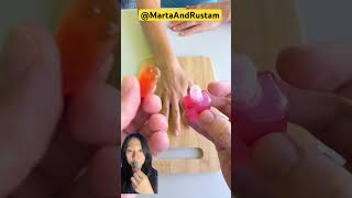 Nail Bite Changed To Nail Candy   Weni Noto shorts