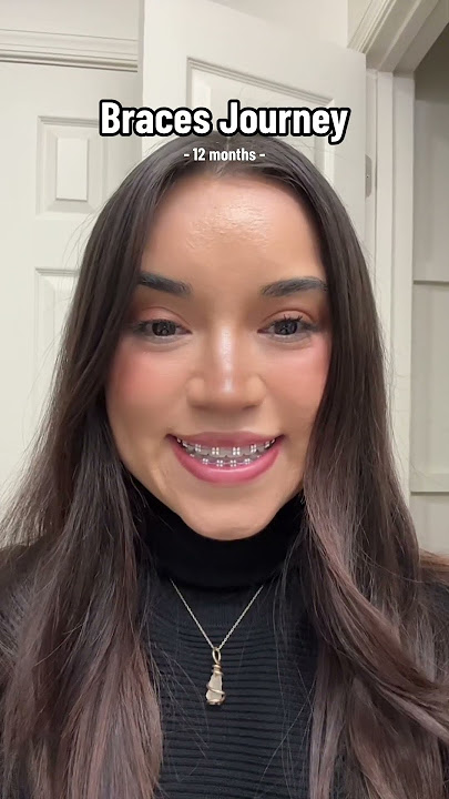 LightForce Braces Transformation