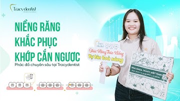 Niềng răng khắc phục khớp cắn ngược với phác đồ chuyên sâu tại Tracydentist | Tracy Dentist