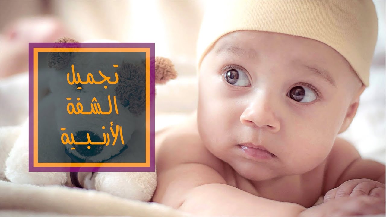 علاج وتجميل الشفة الأرنبية