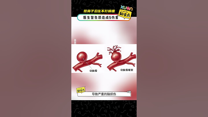 捏鼻子忍住不打喷嚏！医生警告恐造成5伤害