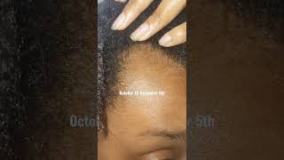 I Shaved My Edges So You Wouldnt Have To Growing Back My Edges Timeline