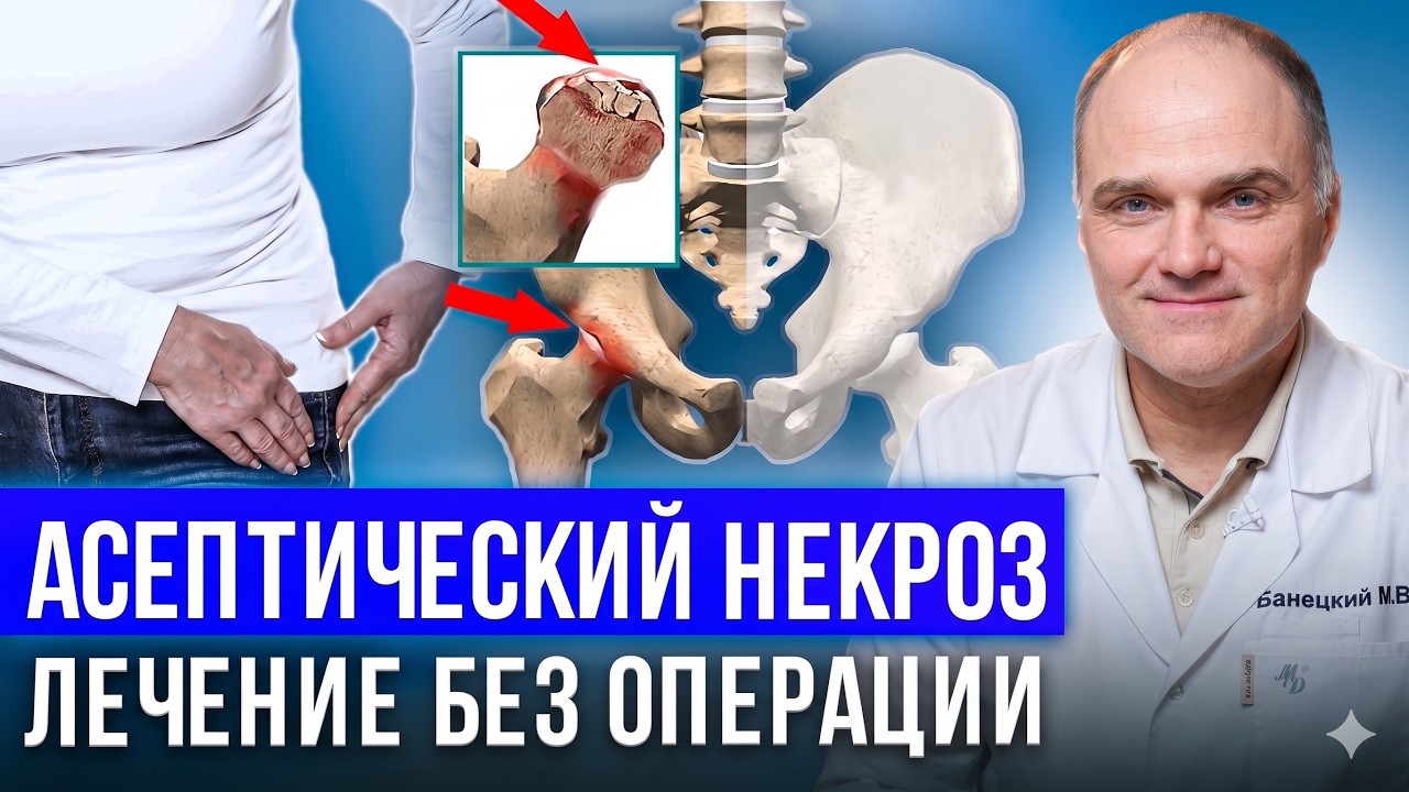 Асептический некроз головки бедренной кости: симптомы, стадии и лечение