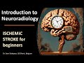 Imaging of acute ischemic stroke the basics