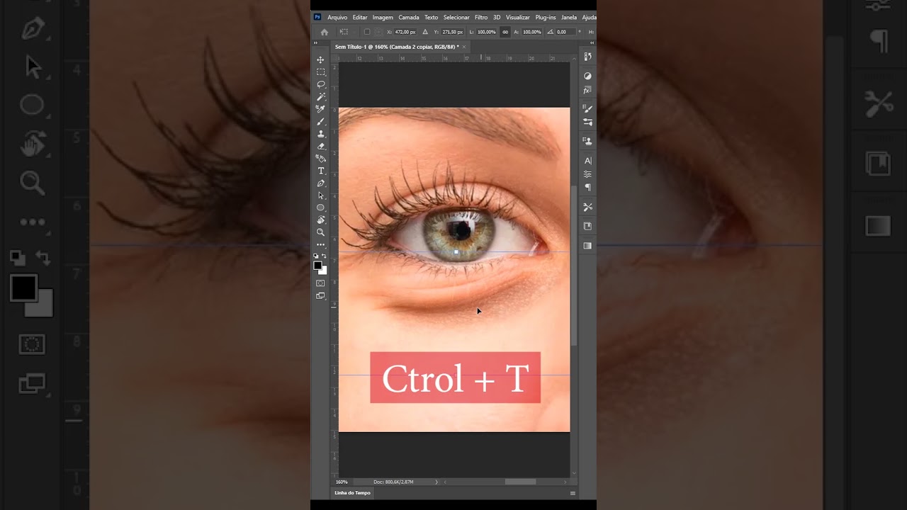 Remover bolsa dos olhos 
