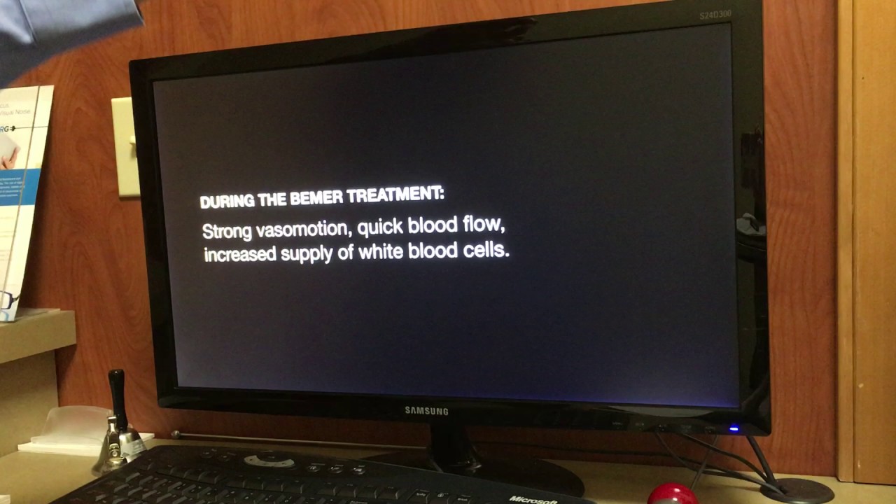 Dr. Wylie Explains the Bemer Machine