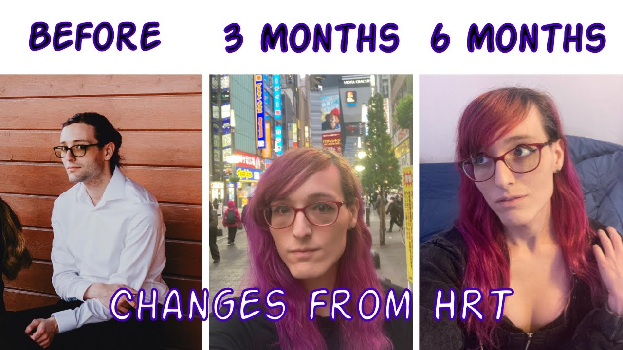 What Does 6 Months of Estrogen Do??? (MtF HRT)