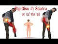 How to fix slip disc  sciatica pain        