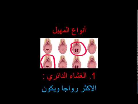 الكس انواع تعرفي على