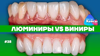 :  VS  |    BG #38