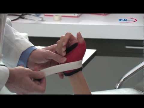 Synthetic casting removable gamekeeper application_EN_by BSN medical.mov