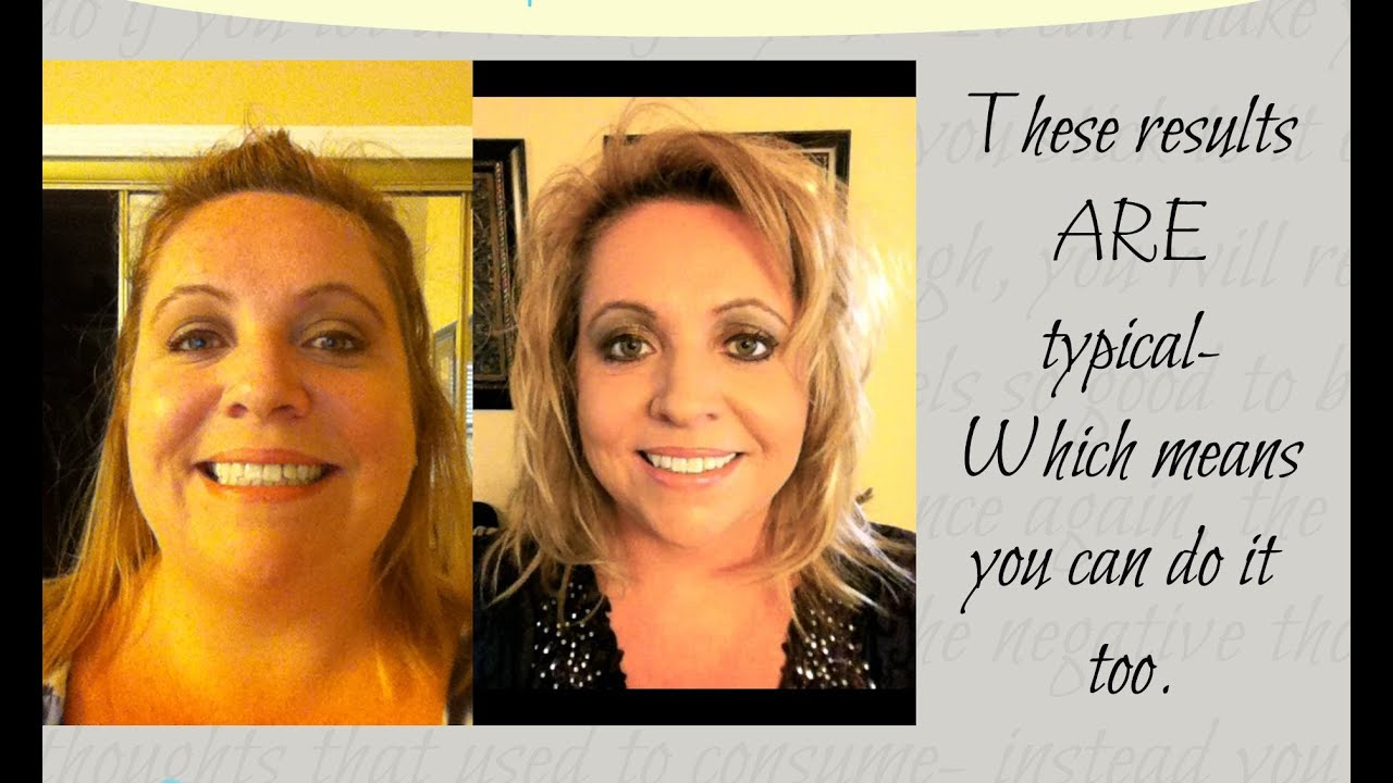 65lb Weight Loss with Prescription hCG drops - Episode 4: hCG Diet Interviews