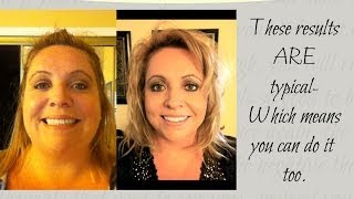 65lb weight loss with prescription hcg drops - episode 4: diet
interviews