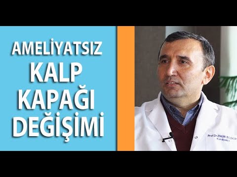 Ameliyatsız Kalp Kapağı Değişimi