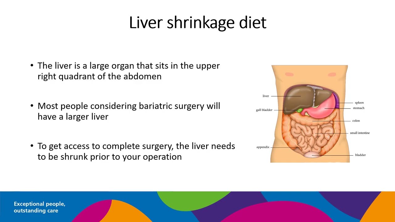 Liver reduction diet for bariatric surgery