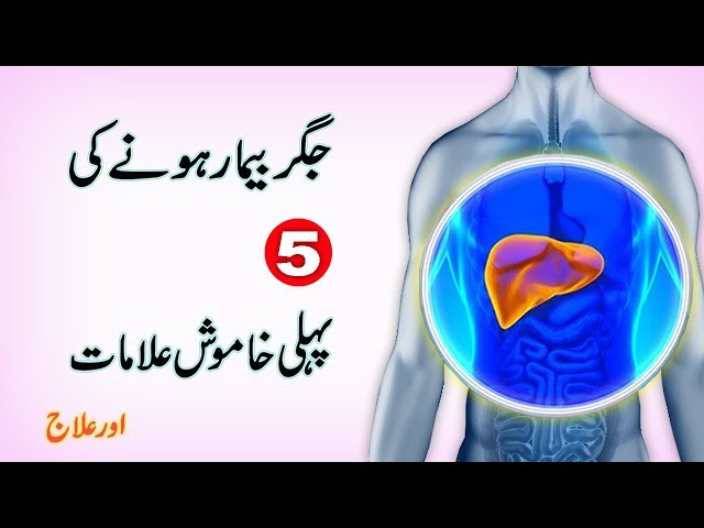 5 Secrits  Signs of Liver Diseases || Silence Symptoms of Liver Failure || Jigar Ka Ilaj class=