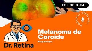 Melanoma de Coroide | Dr Retina 🎙️ #4