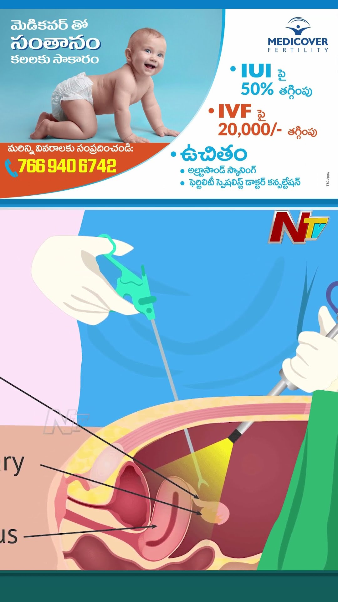 Best IVF Centre Medicover Fertility | Dr. Nidhi Sharma | NTV