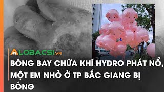 Bóng bay chứa khí hydro phát nổ, một em nhỏ ở TP Bắc Giang bị bỏng screenshot 1