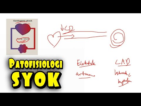 Mekanisme Syok (Klasifikasi, Etiologi, Patofisiologi Syok Kardiogenik, Obstruktif, Distributif)