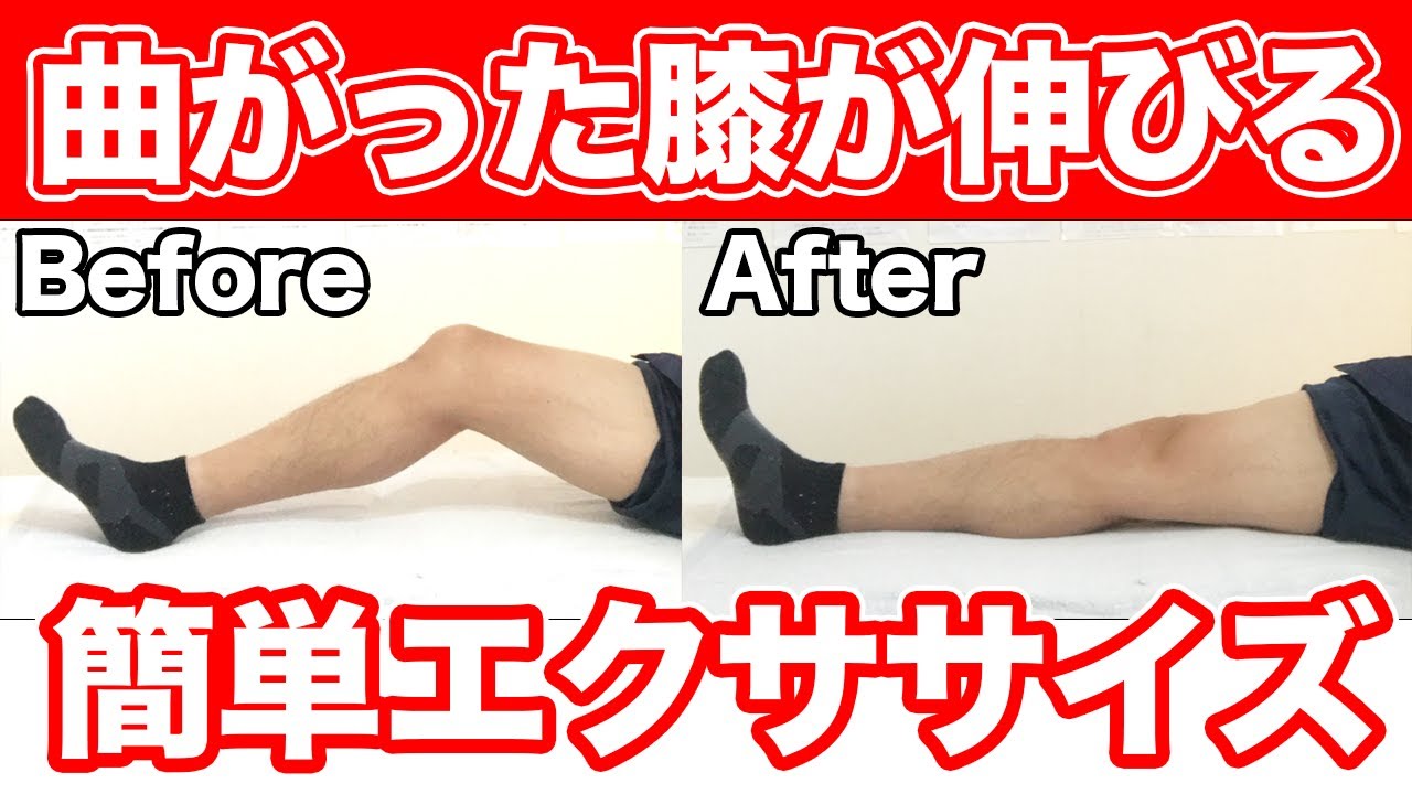 【自分で治す!!】曲がったま伸びない膝を伸ばす簡単エクササイズ【東京　膝の痛み】東京都渋谷区恵比寿の整体院蒼