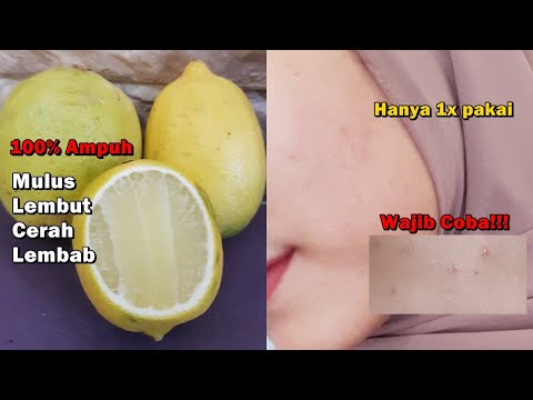Video: Lemon Untuk Jerawat: Bisakah Lemon Dan Jus Lemon Mengobati Jerawat?