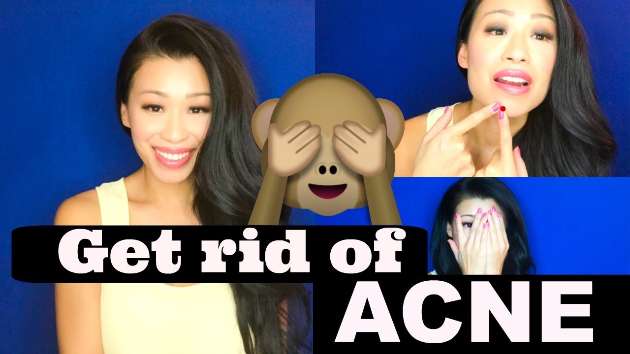 ACNE: HOW TO GET RID OF IT