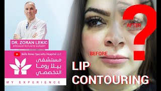 How to do Lip Contouring Procedure in Bella Roma Hospital | كيفيّة تحديد الشفاه