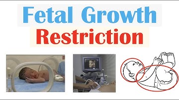 Fetal Growth Restriction (FGR, IUGR) | Types, Causes, TORCH Infections, Diagnosis, Treatment
