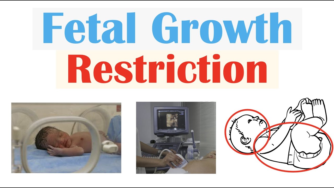 presentation on fetal growth restriction