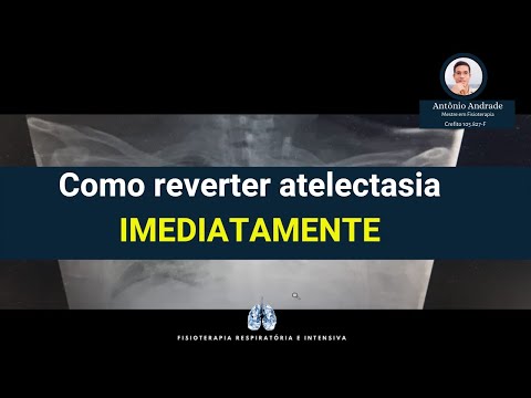 Vídeo: Revisão De Bancada à Cabeceira: Estratégias De Ventilação Para Reduzir Lesões Pulmonares - Lições Da Terapia Intensiva Pediátrica E Neonatal