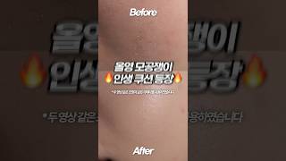 올영 역대급 모공쟁이 인생쿠션 등장이오🔥#올영 #올영추천템 #쿠션추천 #웨메쿠션 #모공