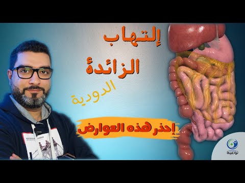 فيديو: ما هو التهاب الزائدة الدودية الغرغرينا؟