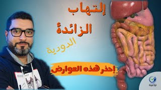 إحذر هذه العوارض | ما هو التهاب الزائدة الدودية | معلومات تعرض للمرة الاولى