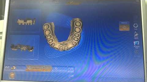 InLab 4.2.5 cracked working on Bluecam AC without any dongle.