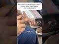Amniotic Membranes