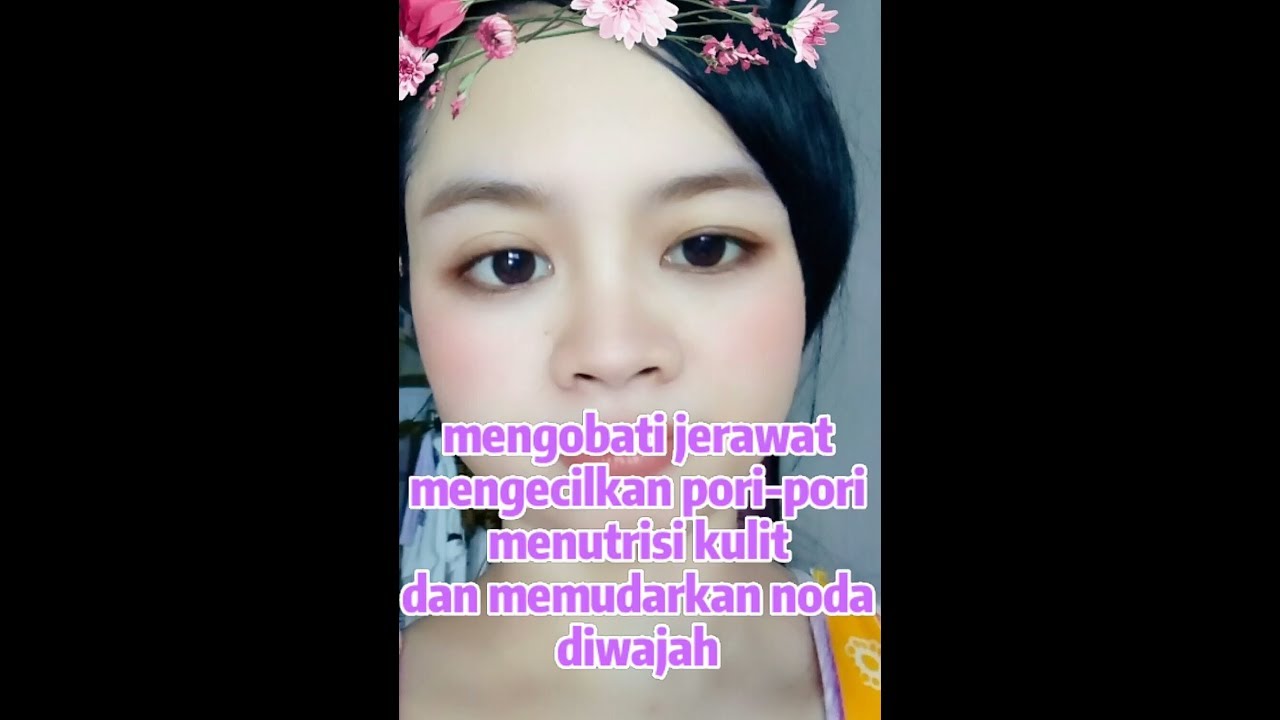 Cara Mengobati jerawat dan mengecilkan pori-pori