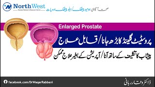 Enlarged Prostate Treatment | Enlarged Prostate Ka Ilaj | Prostate Enlargement | Dr Waqar Rabbani