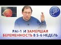 Невынашивание беременности. PAI-1 может ли быть причиной невынашивания на сроке 5-6 недель?