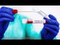 PRUEBA COVID PCR               Enfer Aral | Pruebas 💉de diagnostico👨🏻‍🔬 para covid-19 🦠🆎️🩸