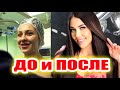 Участницы Дома-2 До и После пластики