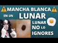 Si ves esta MANCHA BLANCA en un LUNAR ⚠️ NO lo pases por alto ⚠️ se asocia a ENFERMEDADES GRAVES