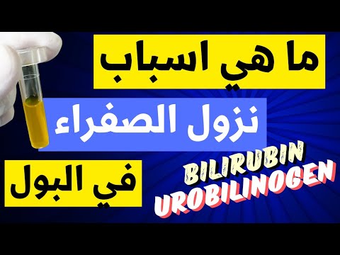 31 اسباب نزول الصفراء البيليروبين في البول  