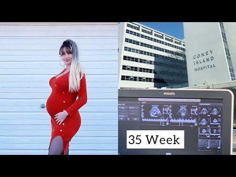 35 Weeks pregnant  | 35 კვირის ორსულობა | Mary  Key