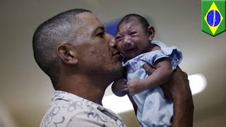 Microcephaly Condition Linked To Zika Virus Causes Babies To Be Born With Shrunken Heads - Tomonews