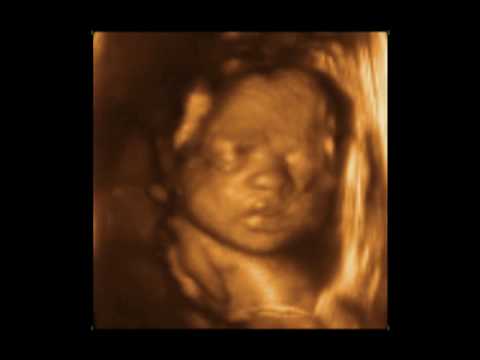 28 Weeks Baby 3D 4D Ultrasound - My Sunshine Baby Charlotte
