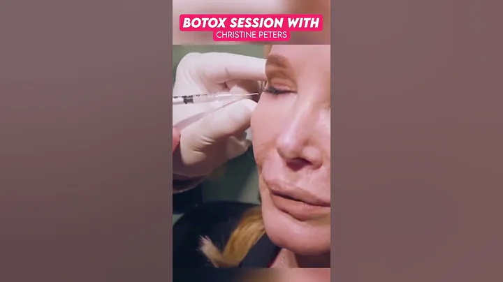 Botox Session With Christine Peters - #thesarashow...
