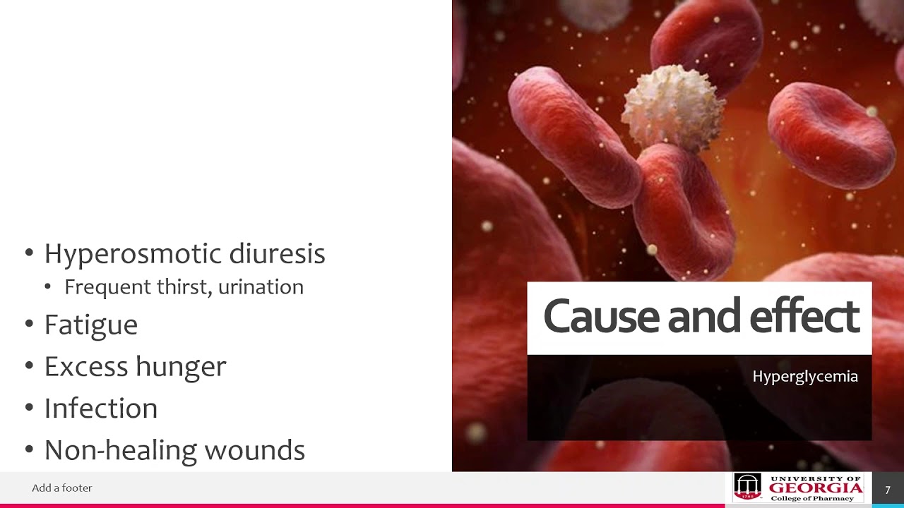 ADA Webinar: Diabetes and Audiological Monitoring of Ototoxic Vestibulotoxic Medications